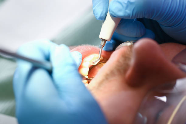 Best Emergency Dental Extractions in Mission, TX